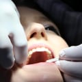 Affordable Payment Plans for Dental Treatment in the UK